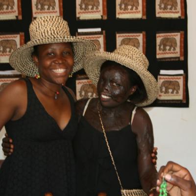 Uganda Acid Survivors 007
