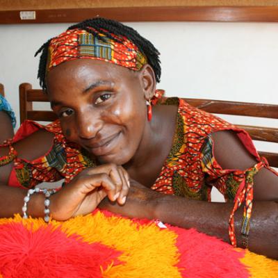 Uganda Acid Survivors 010