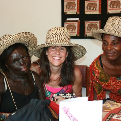 Uganda Acid Survivors 014